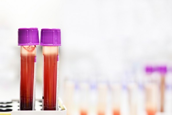 Sognare di donare il sangue